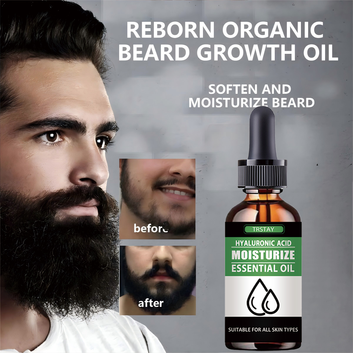 Beard Oil Growth - 100 % natürliches, beschleunigtes Gesichtshaar, wachsen