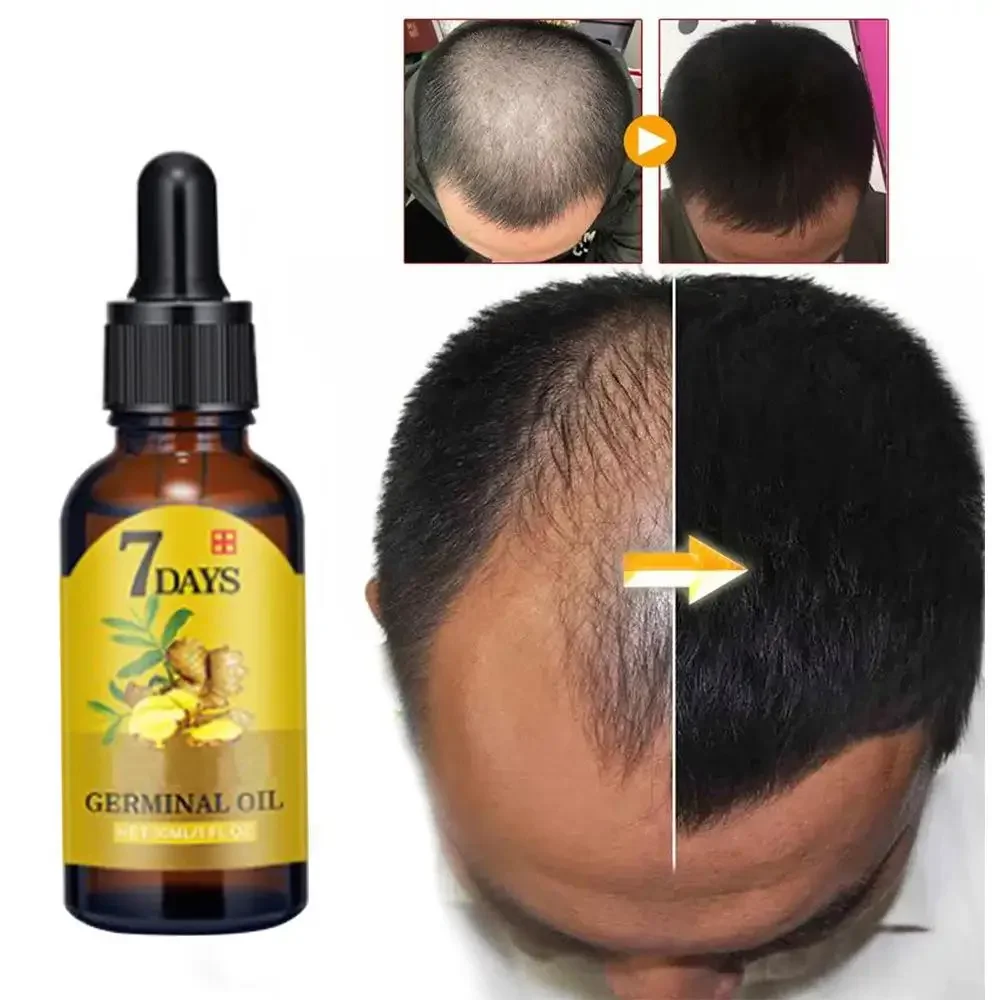 Beard Oil Growth - Haarwachstums-Ingwer, schnell wachsendes Haar, ätherisches Öl,