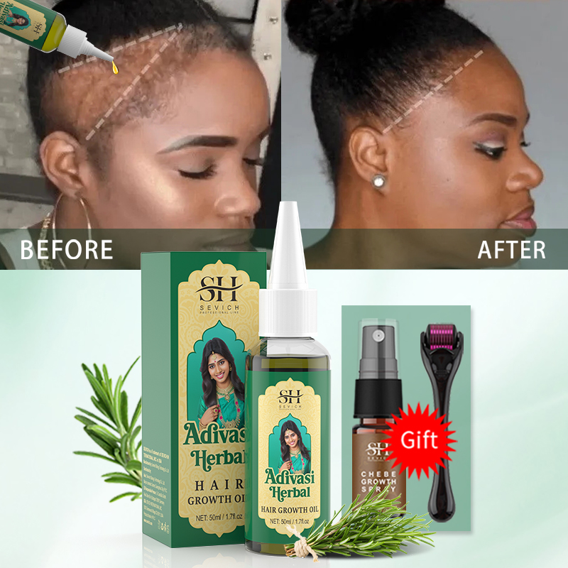 Ayurvedisches Haarwuchsöl Indi – Beard Oil Growth Bewertung und Preis