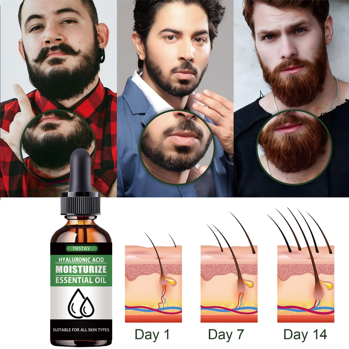 100 % natürliches, beschleunig – Beard Oil Growth Bewertung und Preis