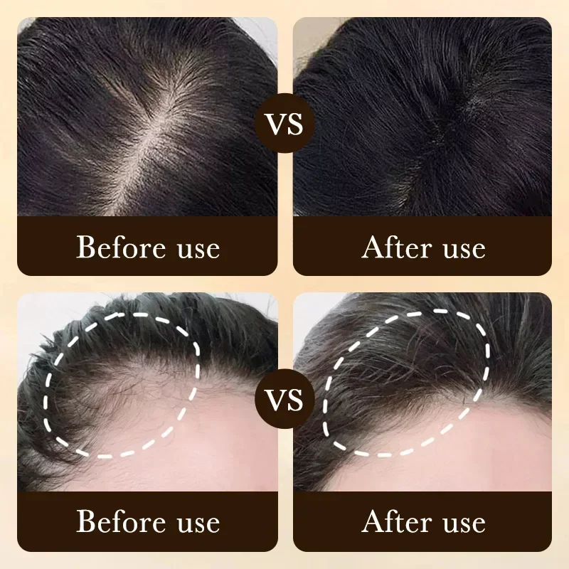 Biotin Schnelles Haarwuchsöl P – Beard Oil Growth Bewertung und Preis