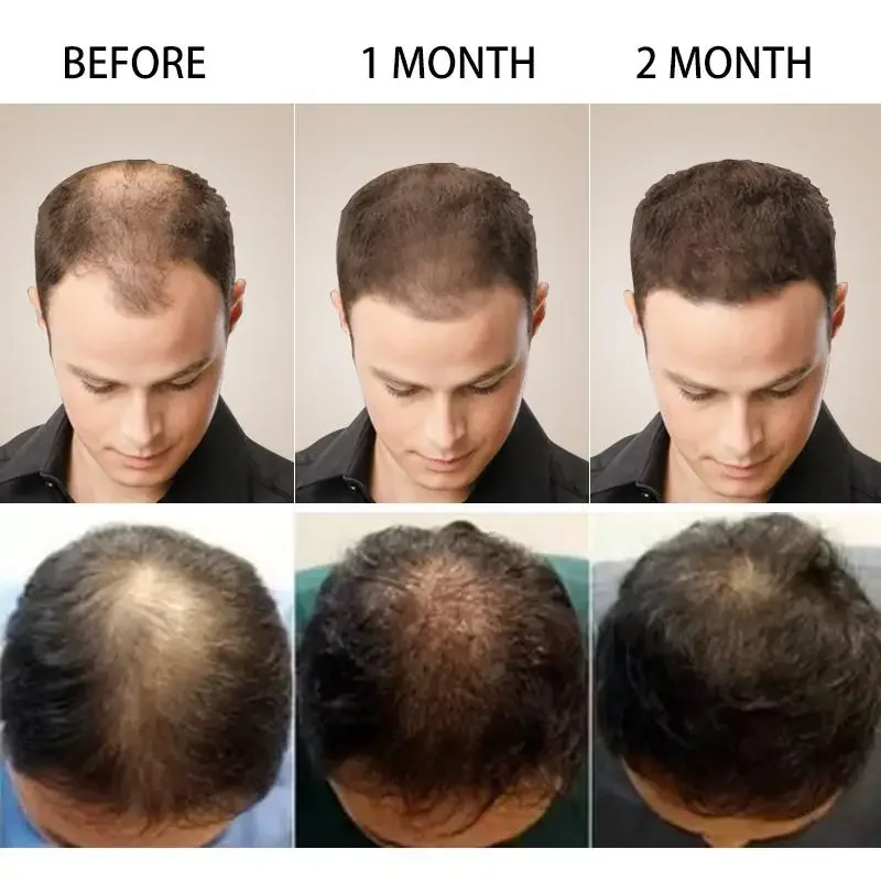 Haarwachstums-Ingwer, schnell  – Beard Oil Growth Bewertung und Preis